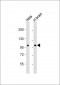 NCOA7 Antibody (N-term)