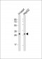 HCCS Antibody (Center)