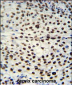 HNRPAB Antibody (N-term)