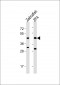 Zebrafish PDHA1 Antibody (Center)