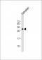 DANRE hoxb8b Antibody (C-term)