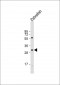 DANRE hoxd11a Antibody (Center)