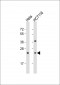 RAB8A Antibody