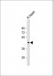 PDK4 Antibody