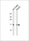 IFITM3 Antibody (N-term)