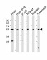 HTR2B Antibody (C-term E423)