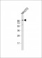 DAG1 Antibody (C-term)