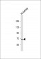 MLL5 Antibody (N-term)