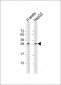 LIN28B Antibody (N-term)