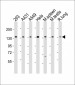 SF3B2 Antibody (Center)