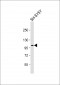 Metabotropic Glutamate Receptor 7 (GPRC1G) Antibody (C-term)