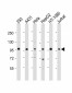 DDX21 Antibody (N-term)