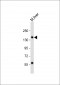 Mouse TSC1 Antibody (C-term S1138)