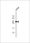 TMX1 Antibody (C-term)