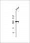 TMX1 Antibody (C-term)