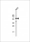 TGFBR1 Antibody (Center)