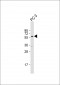 TXNRD1 Antibody (Center)