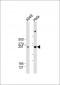WNK1 Antibody (C-Term)