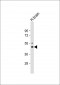 KCNJ2 Antibody (C-term)