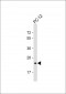 DHFR Antibody (C-term)