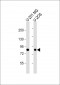 GIT1-S388 Antibody (Center)