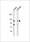 MLK1 Antibody (C-term)