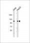 PERK (EIF2AK3) Antibody (Center)