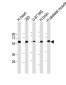 ENTPD2 Antibody (N-term)
