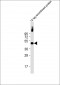 Myc Tag Antibody