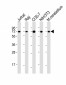 ACHE Antibody (C-term)