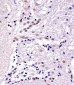 YY1 Antibody