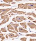 MKRN2 Antibody