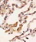 S100A2 Antibody