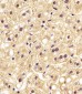 PGK1 Antibody