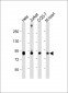 PFKP Antibody (C-term)