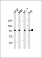 TPX2 Antibody