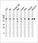 IGF2BP1 Antibody (C-term)