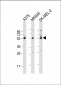 GSDMC Antibody  (Center)