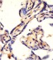 CAD Antibody (Center)