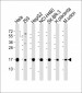 Interferon-inducible protein (IFITM3) Antibody (N-term)