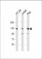 RBL2 Antibody (N-term)
