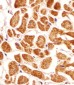 PCCA Antibody (Center)