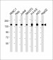 SF3B1 Antibody (N-term)