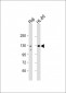 TERT Antibody (S1125)
