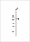 BMPR1A Antibody (Center C180)