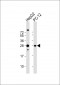 PCMT1 Antibody (N-Term)