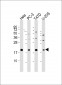 ANAPC11 Antibody (C-Term)