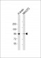 PRKD2 Antibody (Center)