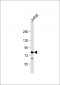 LCP2 Antibody (N-Term)