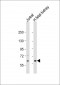 EPHX2 Antibody (N-Term)